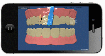 In the game "Monster Chase", monsters are hidden amongst a set of virtual teeth to draw brushing to all regions of the mouth