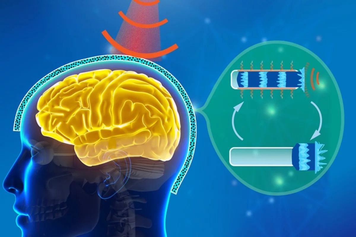 A new liquid foam liner could see football helmets sustain more high-impact forces