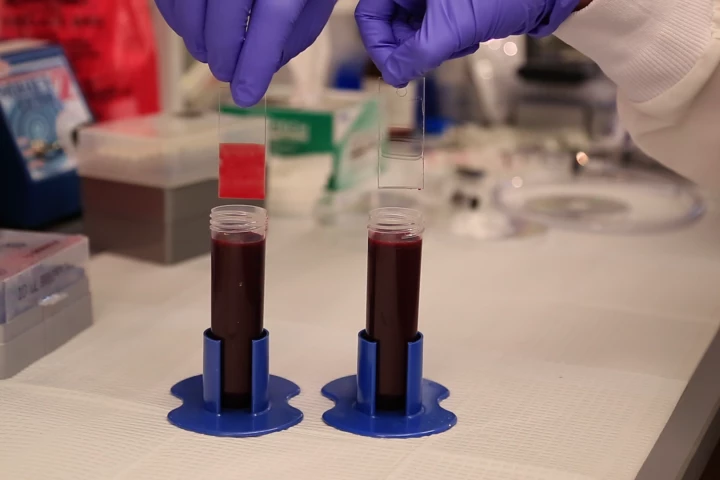 Glass slides dipped in blood to demonstrate the effectiveness of the TLP coating. with blood sticking to the untreated slide on the left while the TLP-treated slide on the right emerges entirely clear (Photo: Harvard’s Wyss Institute)
