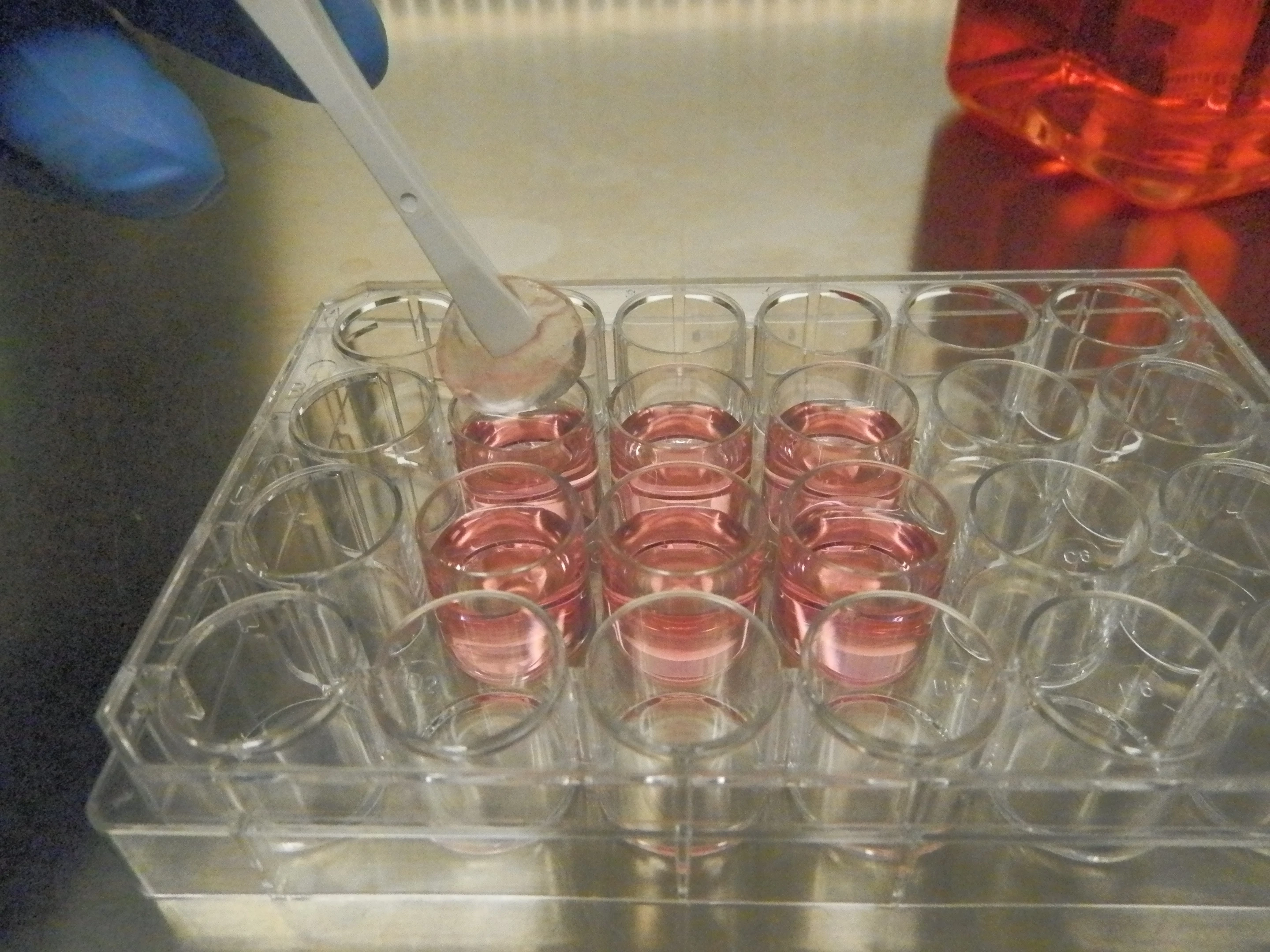 The development of artificial bone marrow stands to greatly increase the availability of treatment for leukemia sufferers (Photo: C. Lee-Thedieck/KIT)