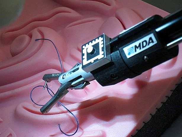 The technology used to track robotic systems in space can be applied to surgical practices such as anastomosis, which involves connecting blood vessels or other structures (Photo: MDA and CIGITI)