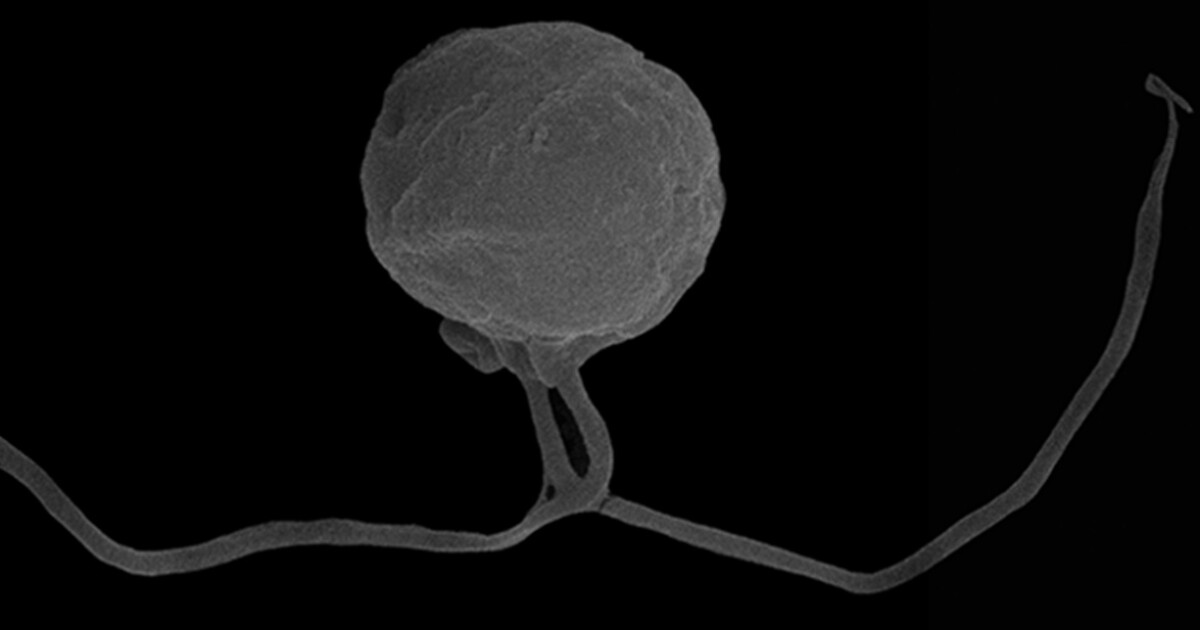 Ravenous Hairy Ogre Microbe May Represent Entirely New Branch On The Tree Of Life
