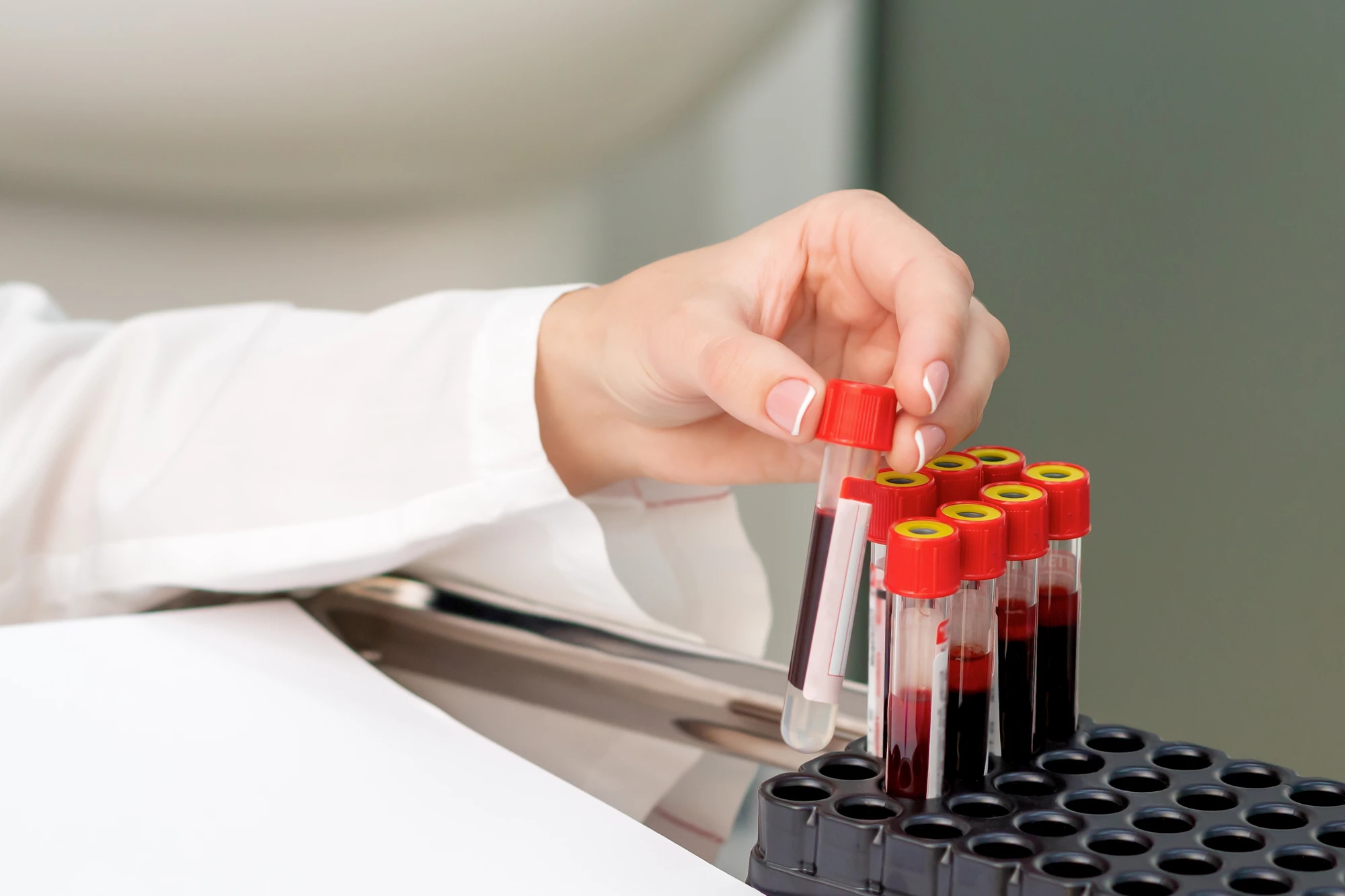 A test could be used as a rapid screening tool in clinics to determine whether a patient's cognitive problems are due to neurodegeneration.