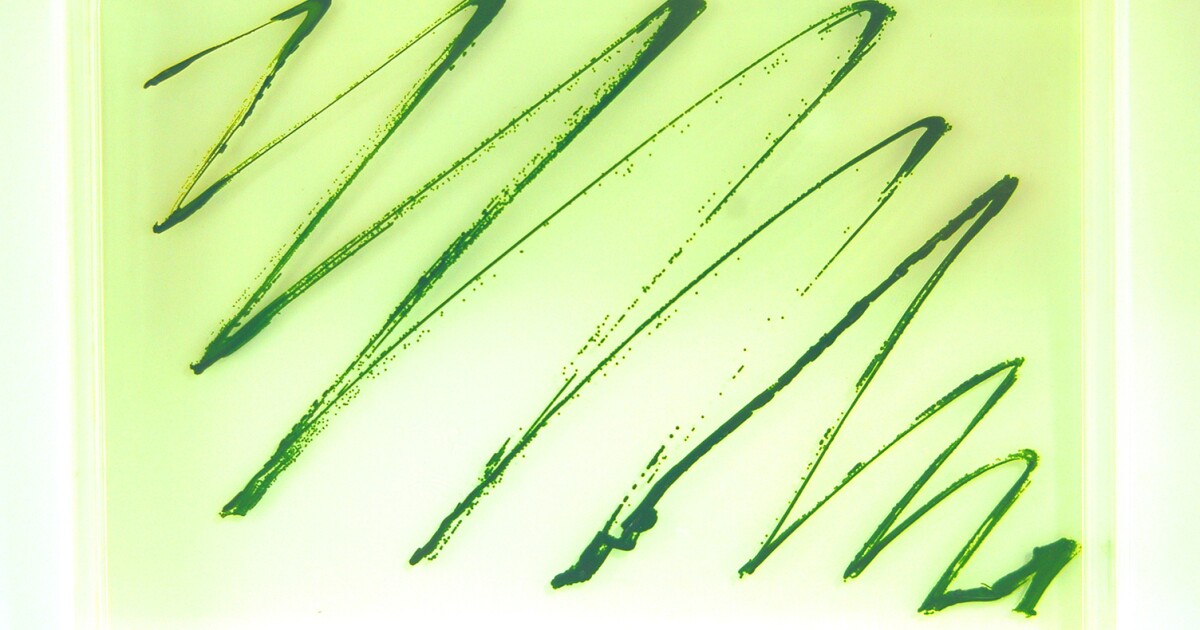 Potentially useful new microalgae discovered in a home aquarium