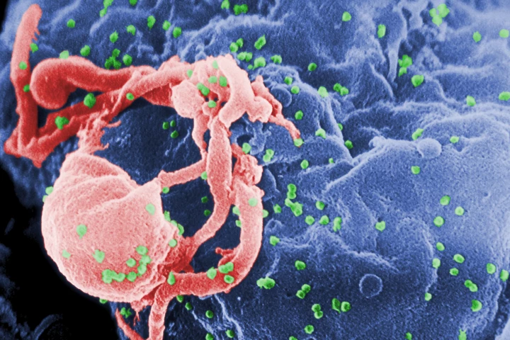 Scanning electron micrograph of HIV-1 budding (in green) from cultured lymphocyte
