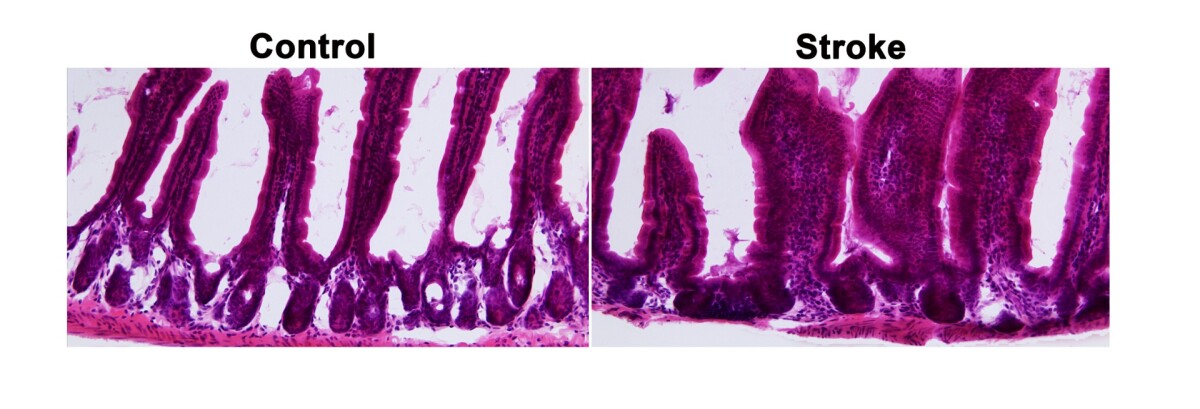 At a microscopic level, intestinal tissue appeared disorganized in models that experienced a stroke (right) but maintained an orderly appearance in healthy models (left)