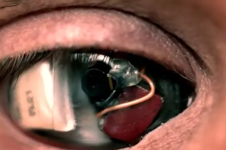 Film-maker Rob Spence has announced that his 'Camera Eye' is now fully functioning (Image: Rob Spence)