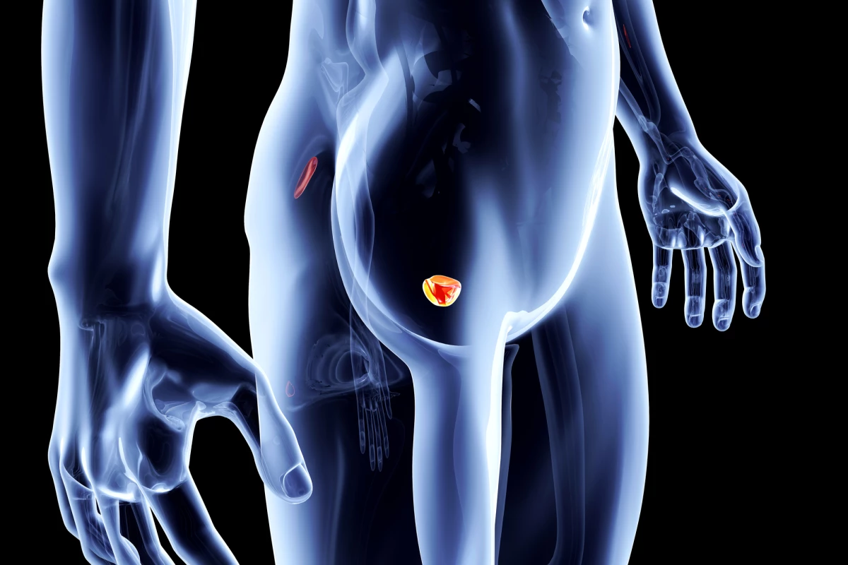 A newly developed AI tool could help diagnose prostate cancer, even before patients have symptoms