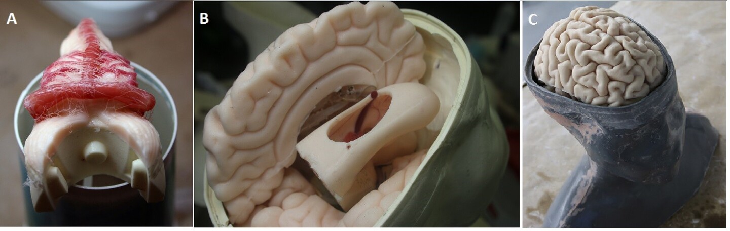 Inside the 3D printed head developed for "Nintendo Neurosurgery" training