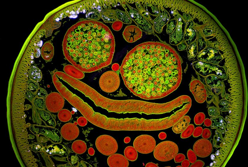 Image of Distinction: Ascaris lumbricoides (parasitic roundworm)