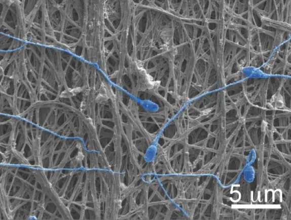 An electron microscope image of the fabric, complete with blocked sperm