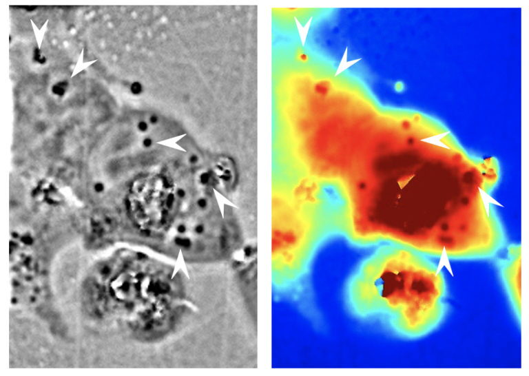 Left: Reflectin nanostructures can be seen inside human cells as the darker areas. Right: Differences in light paths through the material, with red being longer and blue being shorter