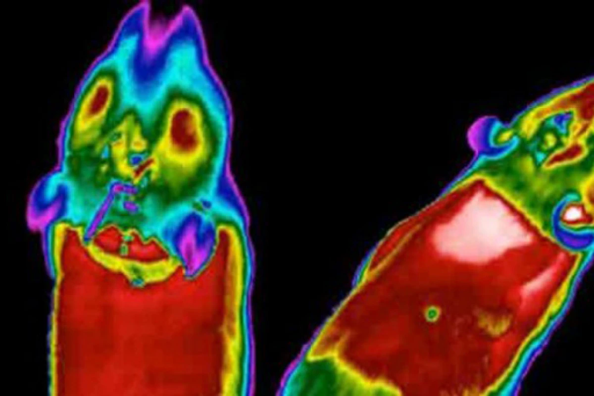 Scientists have discovered a protein that activates brown fat (pictured) in mice (Image: Toni Vidal-Puig)