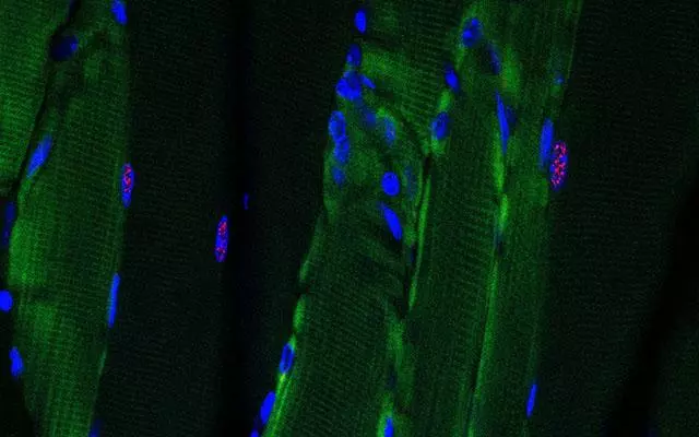 Muscle fibers treated with a new RNA-targeted Cas9 technique show a lack of toxic RNA buildup (seen in red)
