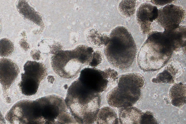 Blood progenitor cells