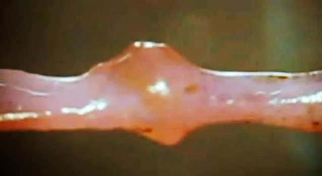 The mini heart takes the form of a cuff of cardiac tissue, wrapped around a vein