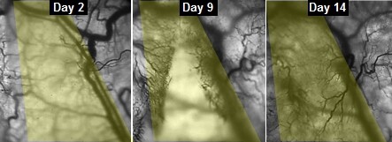 These images document the process of veins gradually growing into implanted muscle fibers