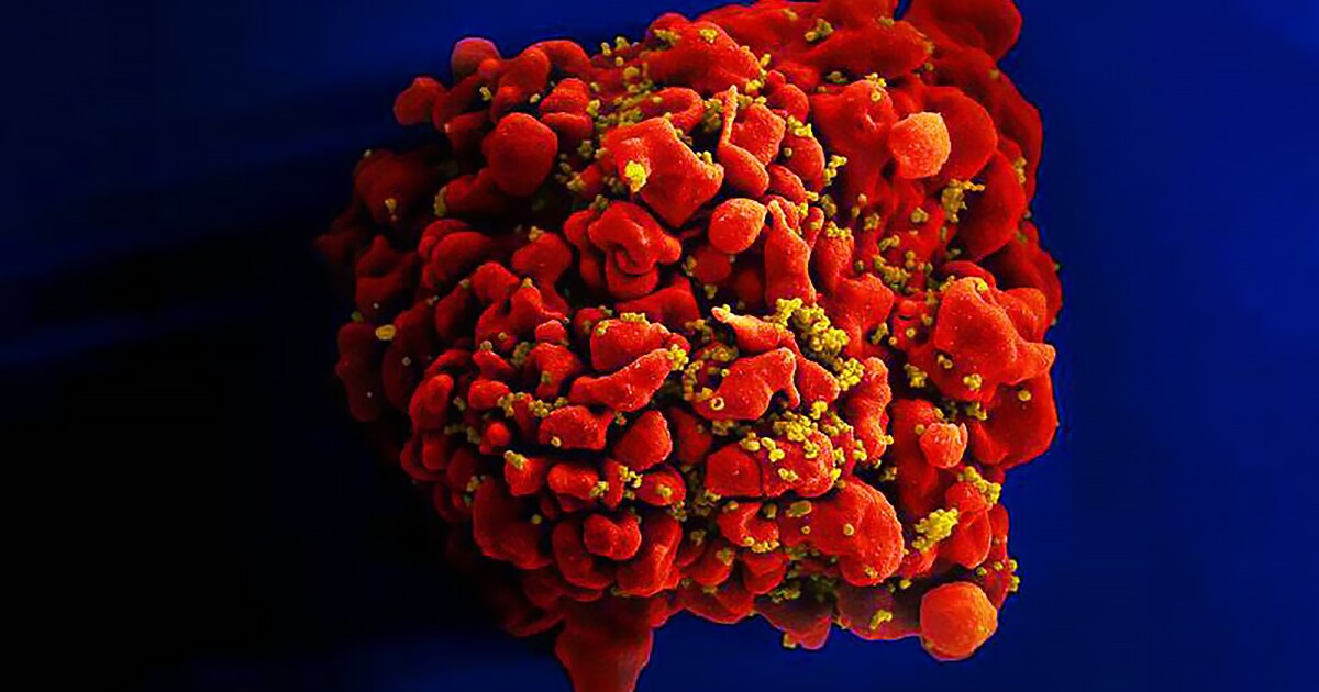 New insights into HIV integration may lead to therapies New insights into HIV integration may lead to therapies