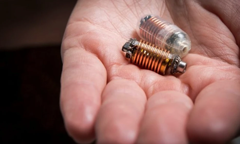 A capsule under development at RMIT University can measure gases in the gut with 3,000 times the accuracy of standard breath-testing