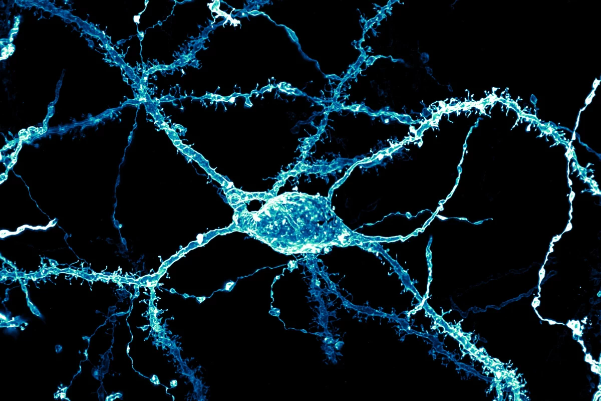 8th place: A neuron densely covered in dendritic spines from the striatum of an adult rat brain