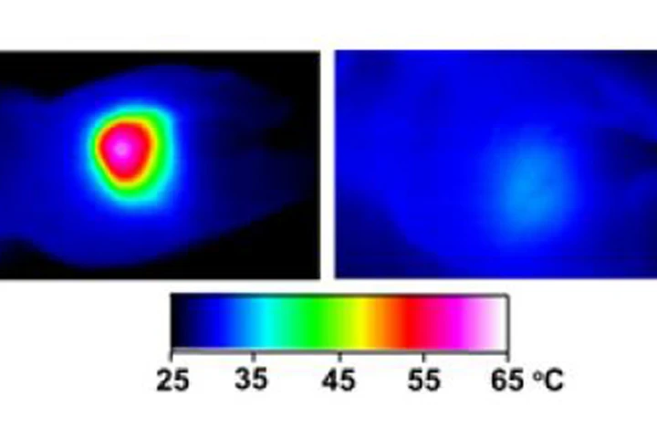 In nanocage-injected mice (left), the surface of the tumor quickly became hot enough to kill cells - in buffer-injected mice (right), the temperature barely budged (Image: WUSTL)