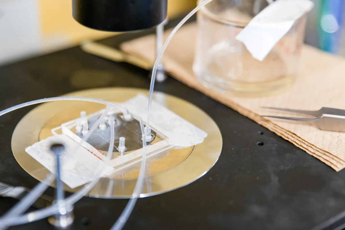 The new pancreatic islet cryopreservation method could help type 1 diabetes patients be less dependent on insulin injections