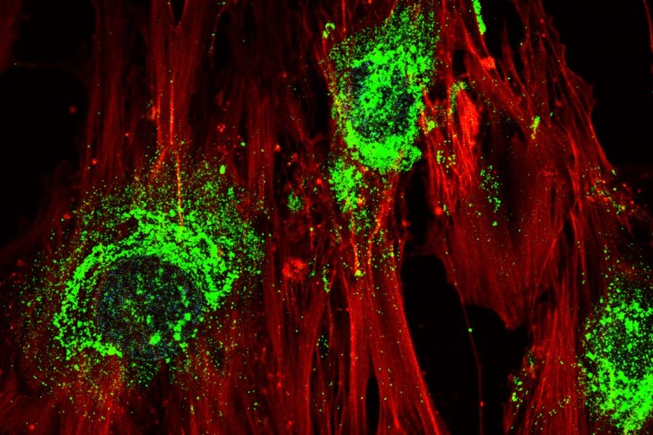 A microscope image of stem cells turning into bone cells – green indicates collagen, which the cells produce as a by-product of the process