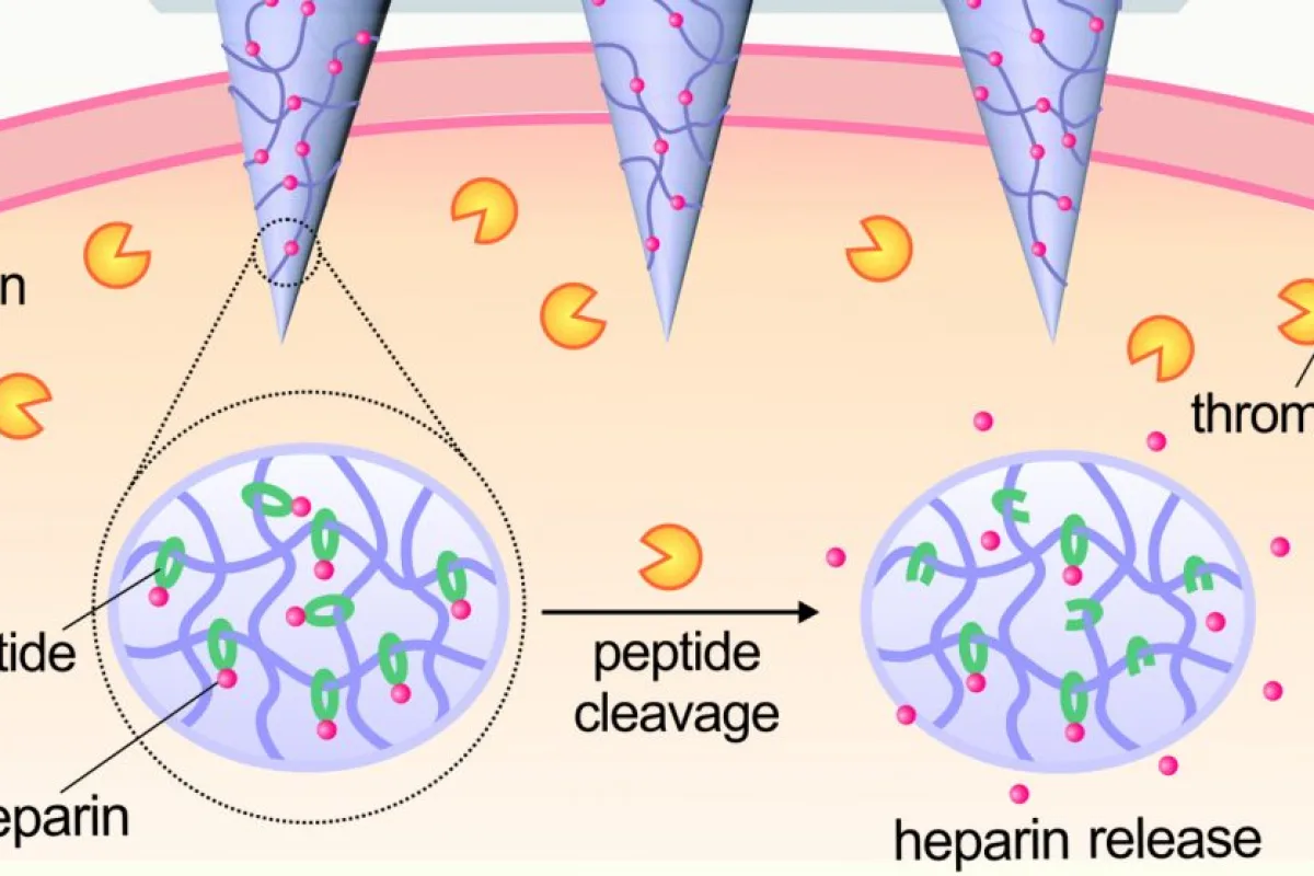 An illustration showing how the microneedles dissolve in the presence of thrombin to release their clot-busting payloads