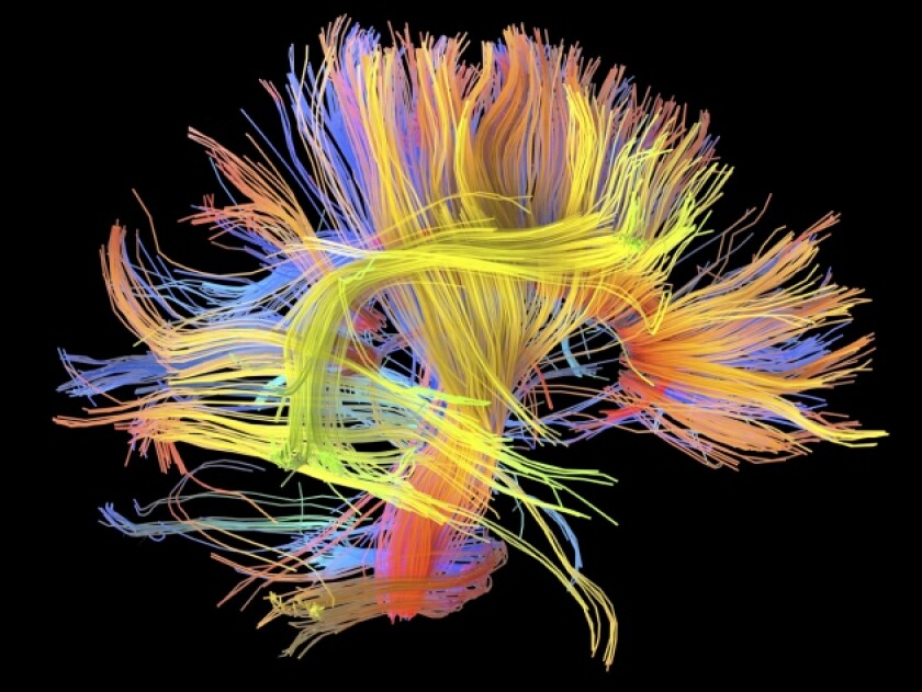 Can we build a complete wiring diagram of the human brain?