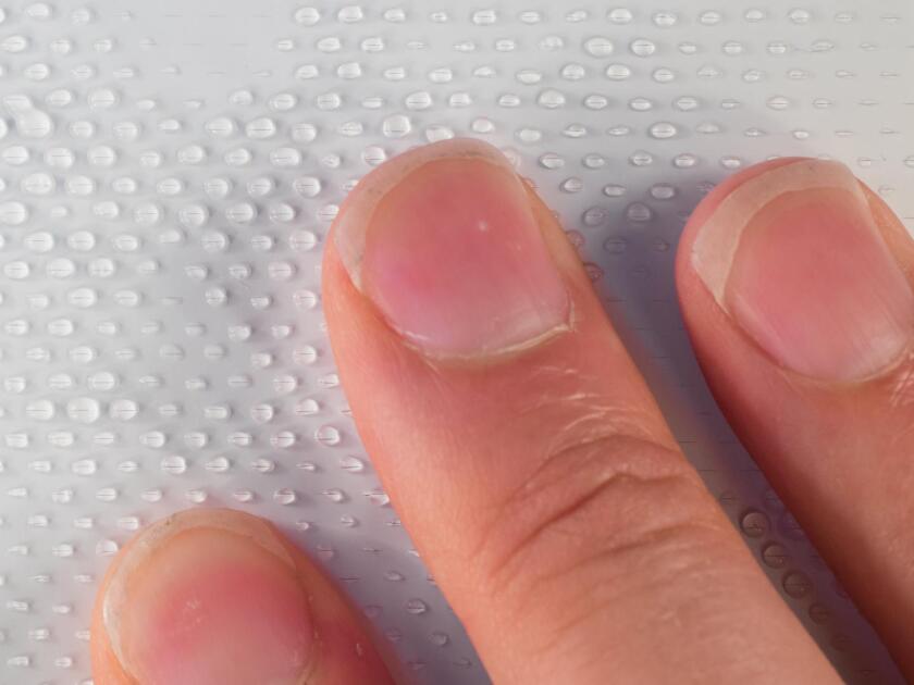When someone pushes on a Surfaceskin pad, the pressure forces alcohol gel out of a reservoir within it, and through tiny holes on its surface