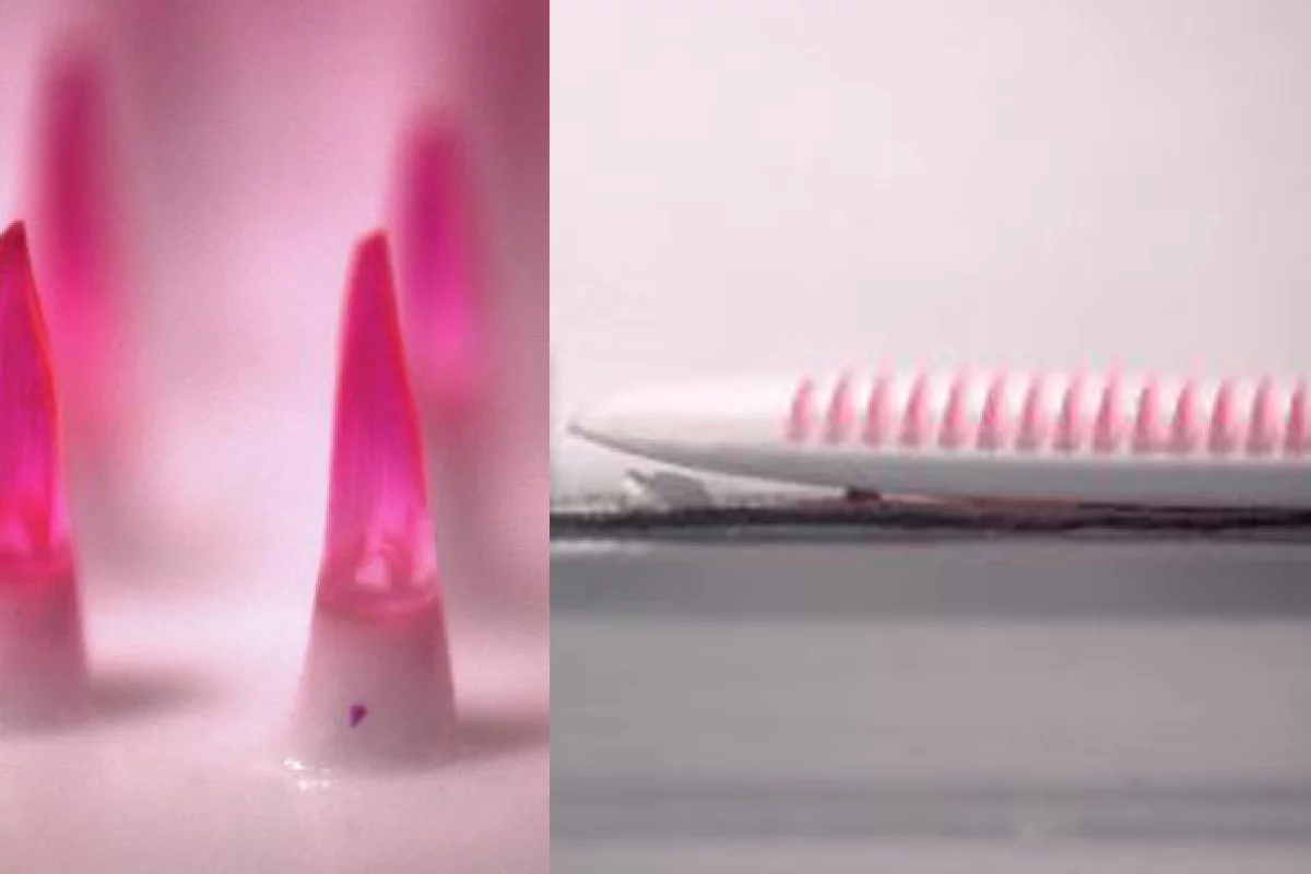 Dissolving microneedle vaccines: cheaper, less painful, less dangerous and more effective than a syringe