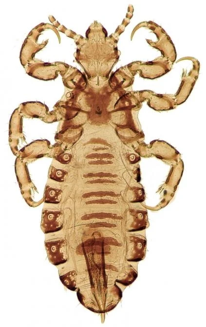 Head lice like the one shown in this image taken through an light microscope infest an estimated 6 million to 12 million Americans annually. University of Utah researchers have developed a machine, called the LouseBuster, and shown that it can effectively