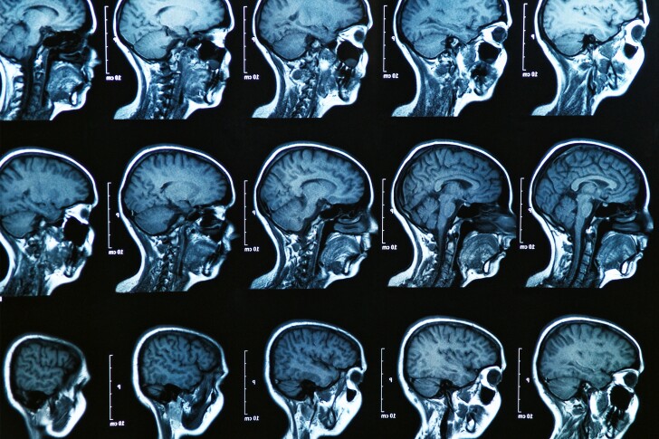 More than 100,000 MRI scans were used to develop the first chart measuring normal brain changes over a human lifetime