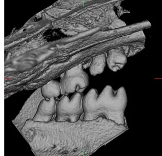 Implanted teeth on day 20