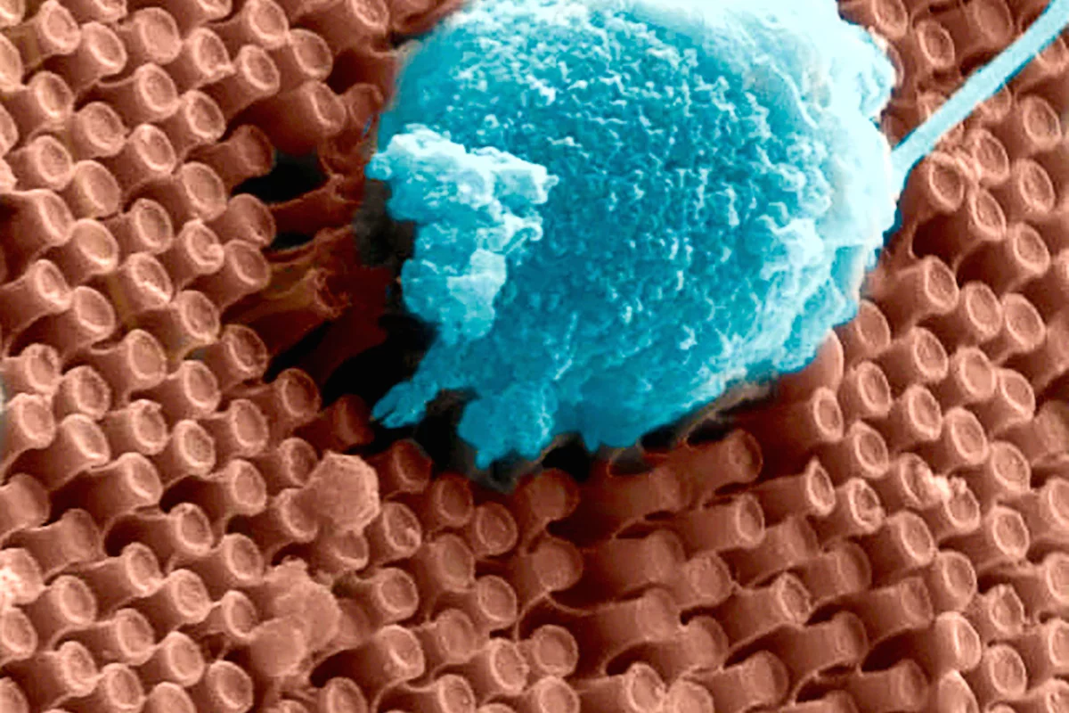 Researchers at UC San Diego have developed a nano-scale retinal implant that could restore sight with higher resolution than other bionic eye systems