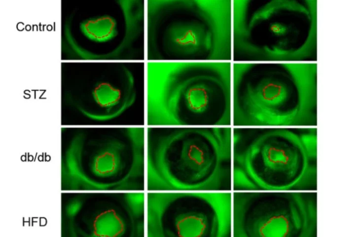 From left to right, the top row shows the wound shrinking in the cornea of a healthy mouse, while the lower rows show a lengthened healing process in a diabetic mouse