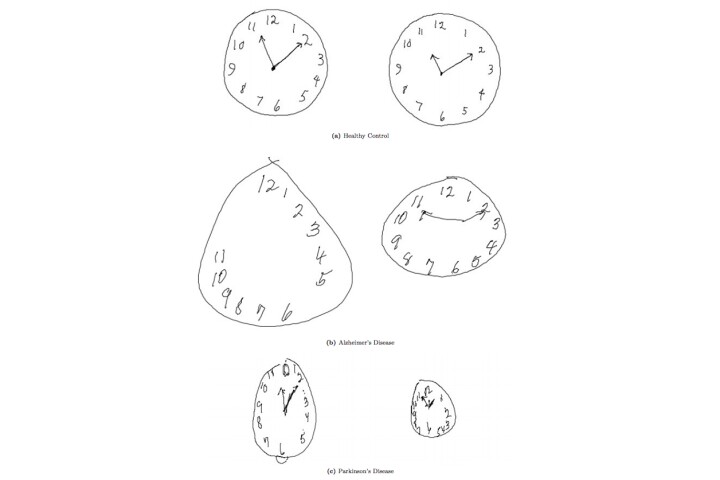 MIT researchers have updated the Clock Drawing Test (CDT) to the digital age