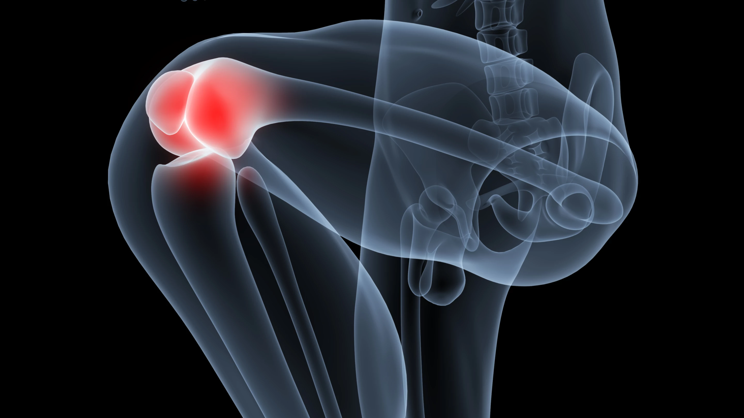 A new understanding of a key protein in the inflammation process has raised the prospect of new drugs for conditions like rheumatoid arthritis