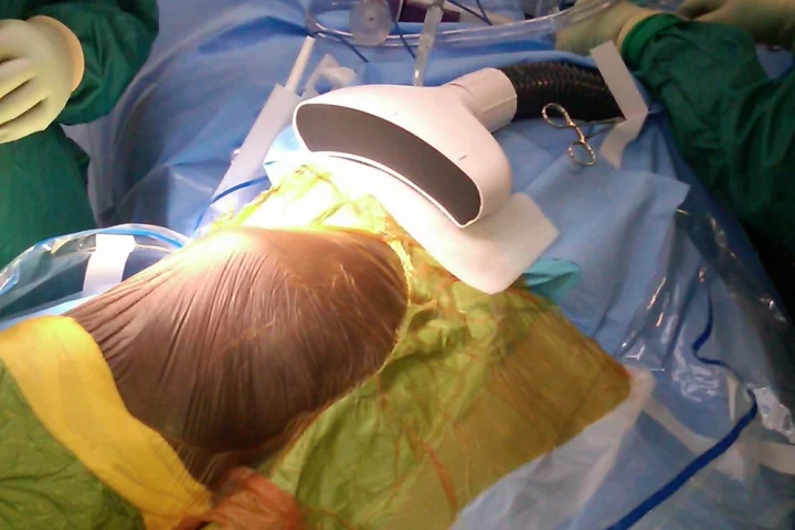 The Air Barrier System (ABS) which aims to reduce infection by providing a cocoon of highly purified air around the incision site during surgery (Photo: Nimbic Systems, Inc.)