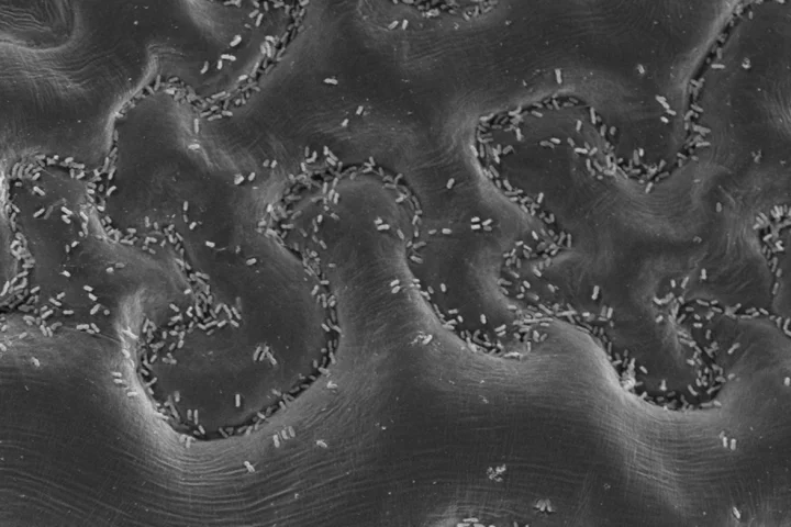 This bustling bacterial metropolis is located on a leaf, and it might just help us discover new antibiotic candidates