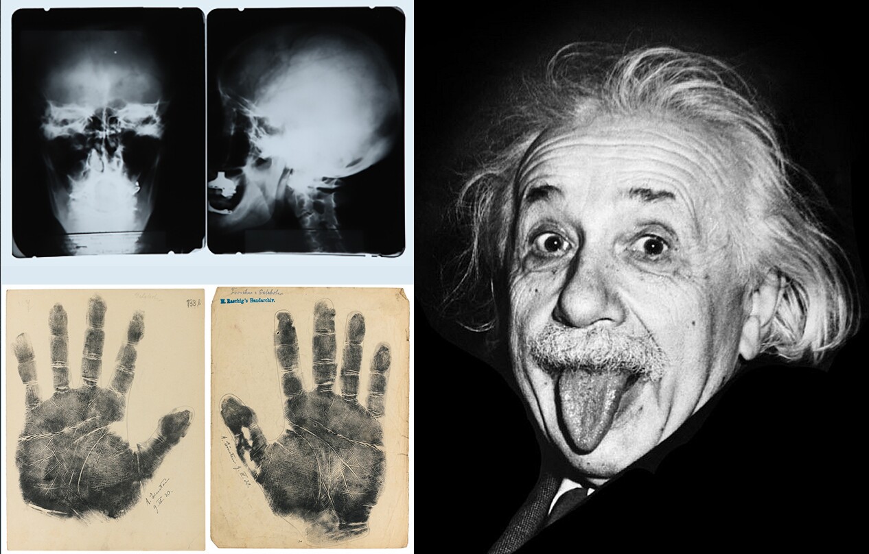 In 2010, X-rays of Einstein's skull sold at a Julien's auction for $38,750, a signed impression of Albert's handprints has sold for $85,000and a print of the image at right (with his tongue poking out) from his 72nd birthday party sold at auction for $56,250 in January, 2015.