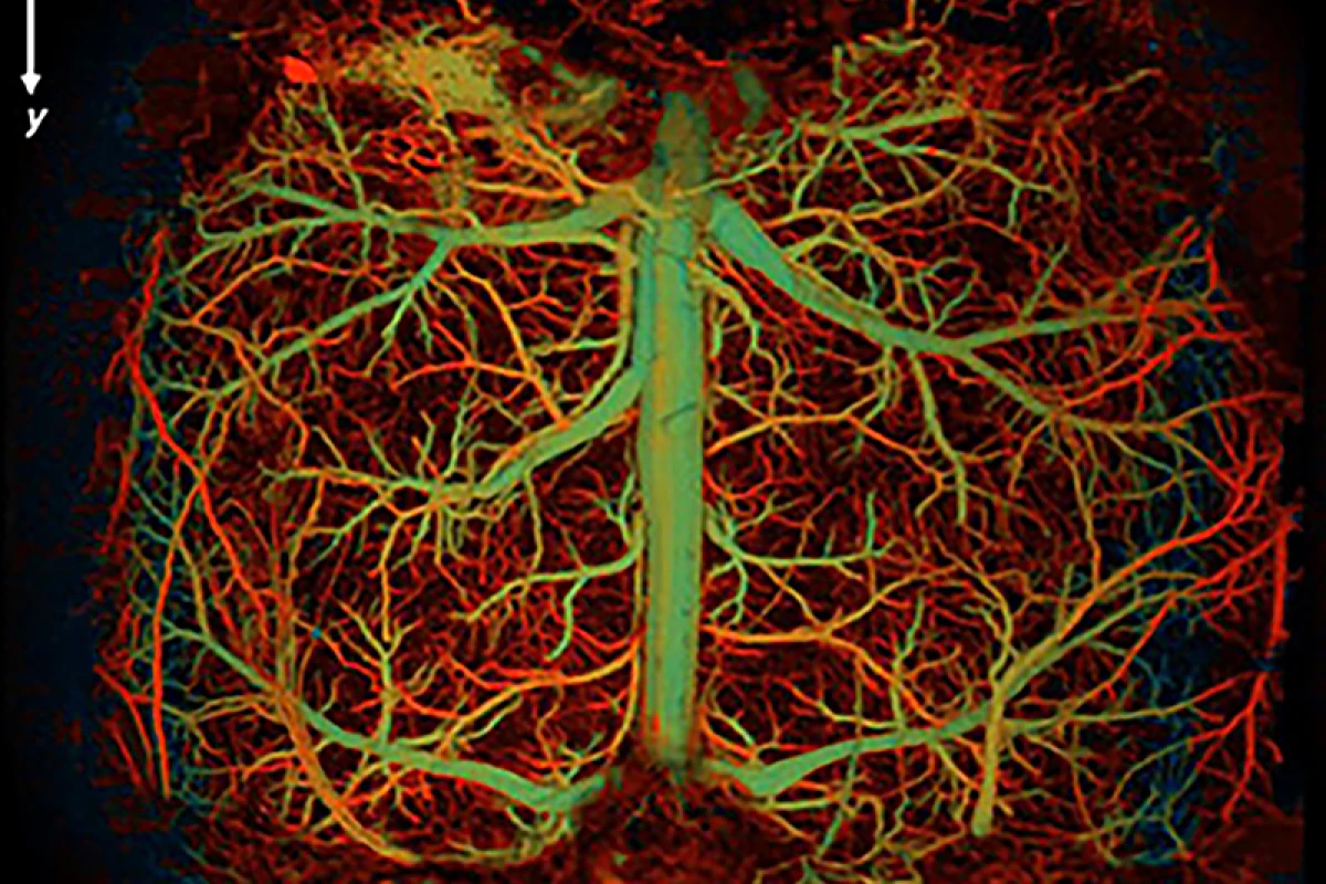 Ultrafast functional photoacoustic microscopy (UFF-PAM) has been used in mice to capture real-time, high-speed images of the brain