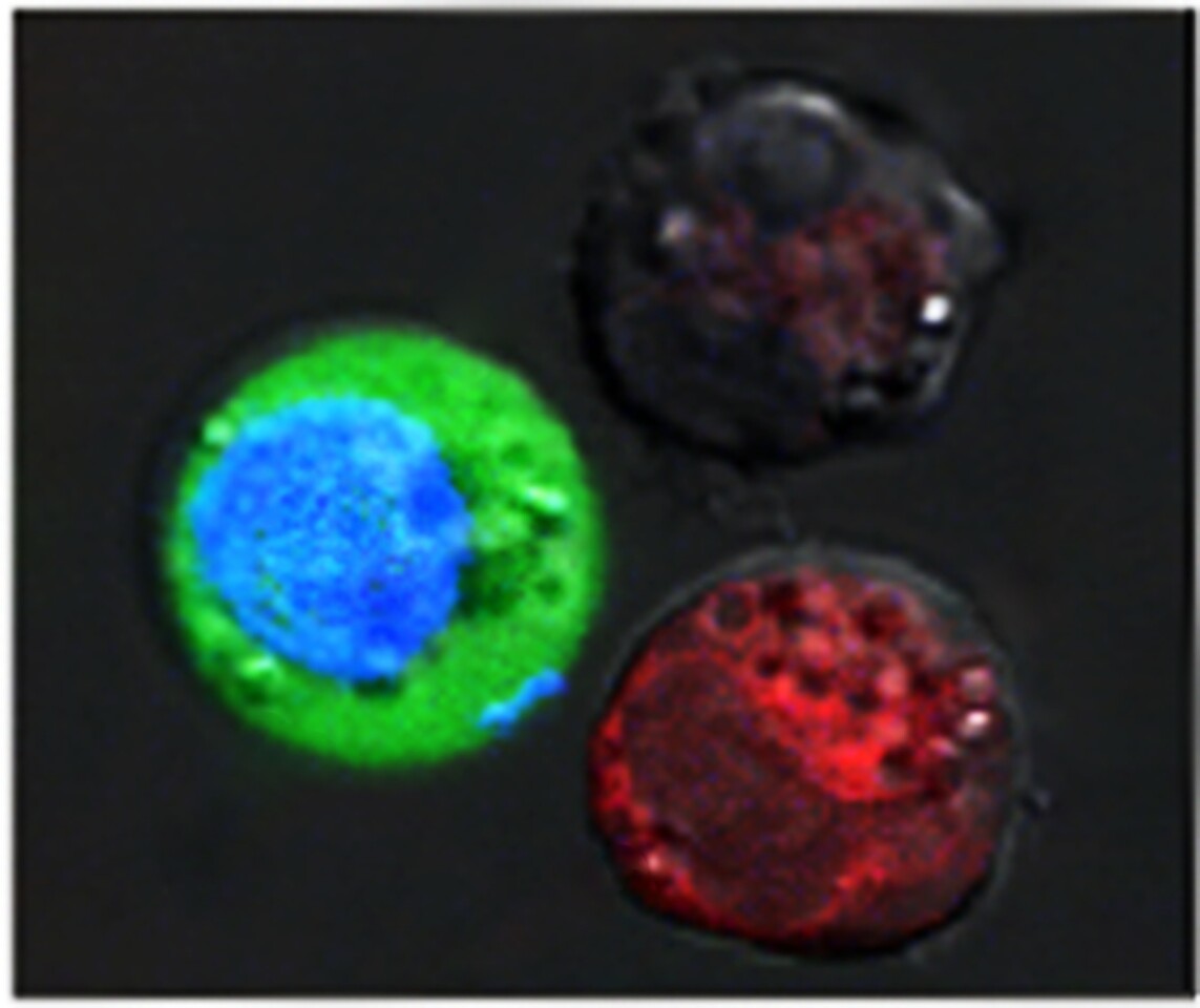 After the laser pulse, red-stained cells show evidence of massive damage from exploding nanobubbles, while blue-stained cells remained intact, but with green fluorescent dye pulled in from the outside. (Credit: Plasmonic Nanobubble Lab/Rice University)