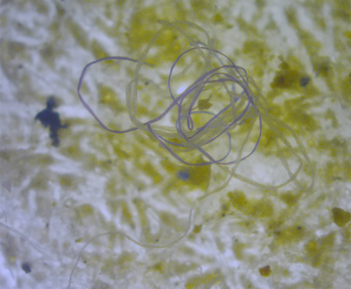 Microplastic fibers (above) are common in marine environments as they come from trash and fishing nets
