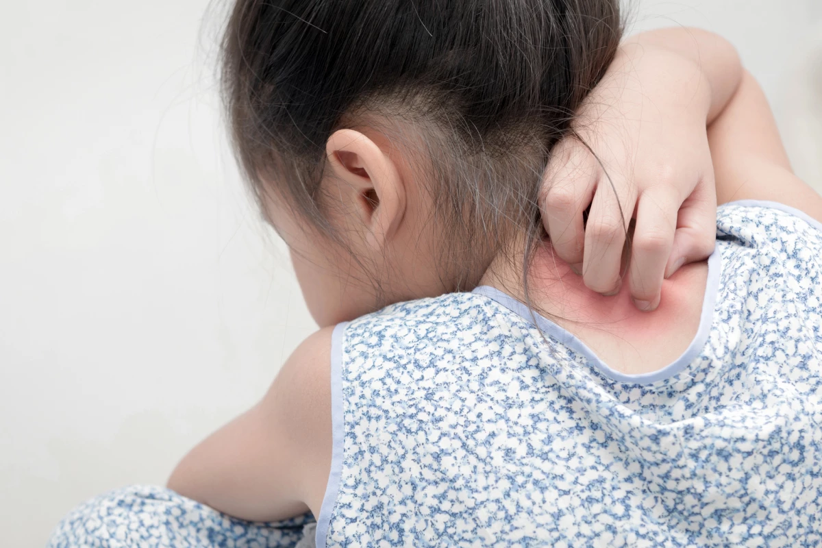An everyday antimicrobial has been linked to childhood allergies