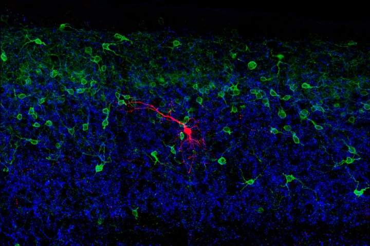 Scientists have mapped a cluster of neurons that aid our understanding of what keeps us from falling over (Image: Steeve Bourane/Salk Institute for Biological Studies)