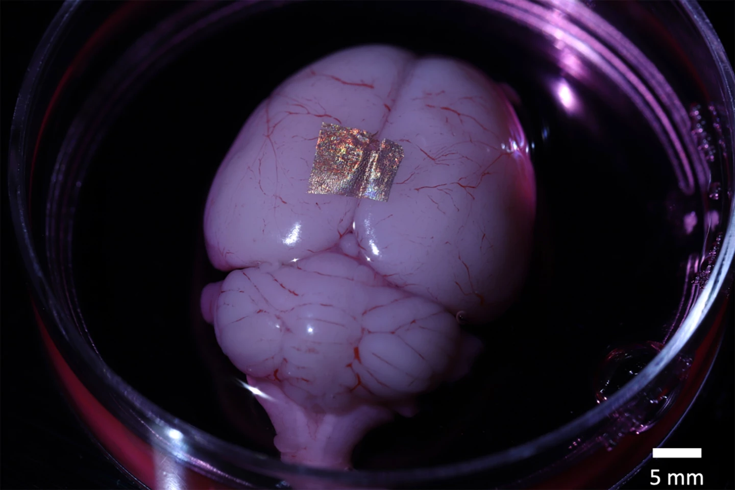 Nanowire array on a rat brain