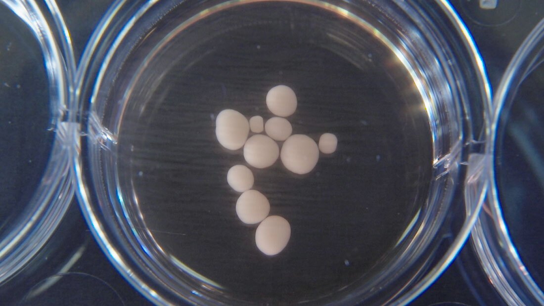 The mini-brains grown in the lab are about the size of peas