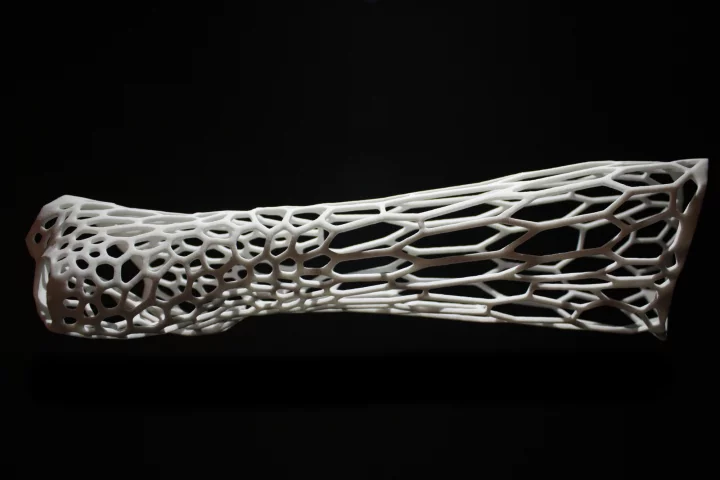 Jake Evill's Cortex concept uses 3D printing technology to create a bespoke exoskeletal cast