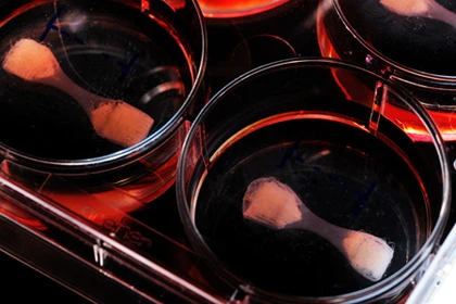 Culture dishes with muscle tissue fastened with Velcro (Image: Eindhoven University of Technology/Bart van Overbeeke)